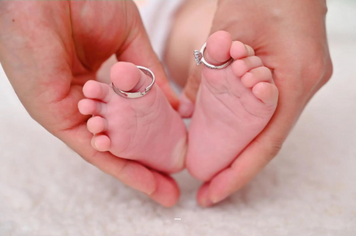 资阳孕妇怎样预防妊娠纹